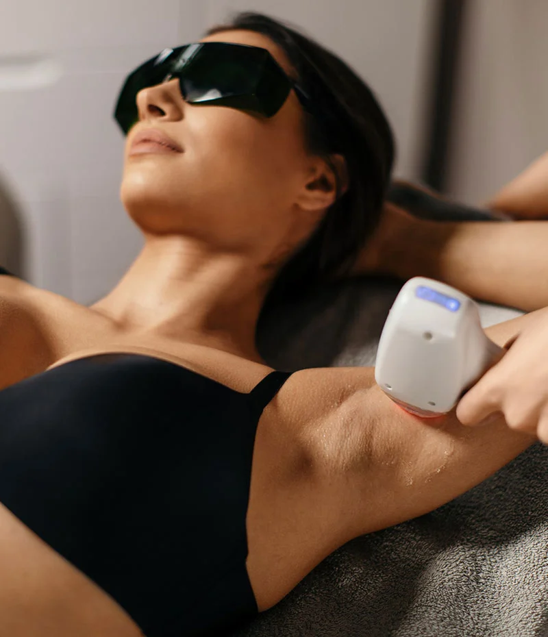 Woman receiving laser hair removal treatment in her underarms