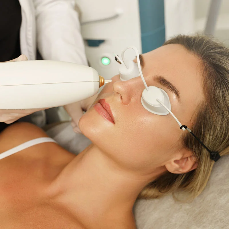 Women getting laser treatments to her face