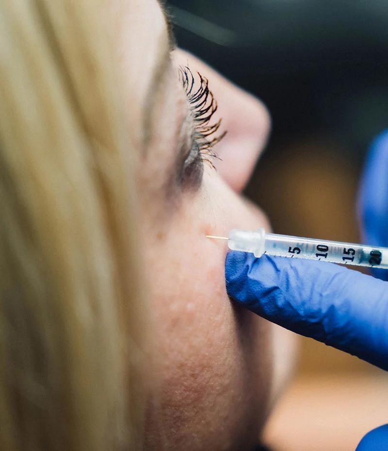 Woman receiving BOTOX injection