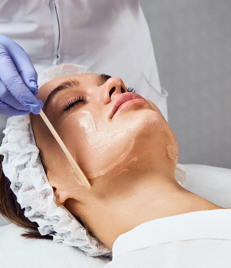 Women getting a chemical peel