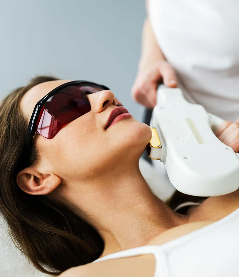 Woman receiving IPL Photofacial treatment