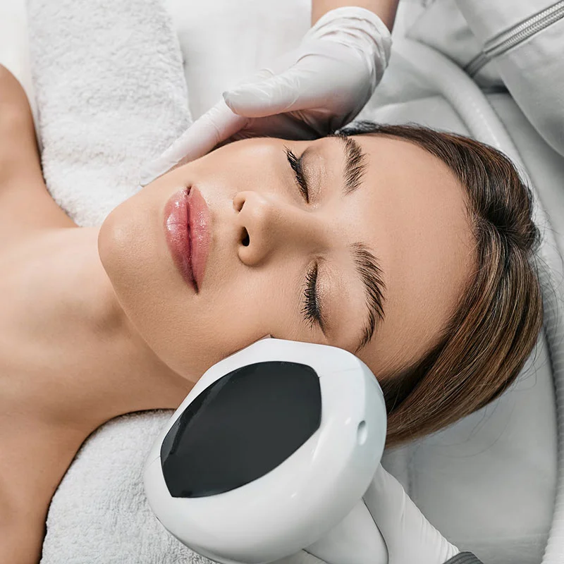 Woman receiving IPL Photofacial treatment